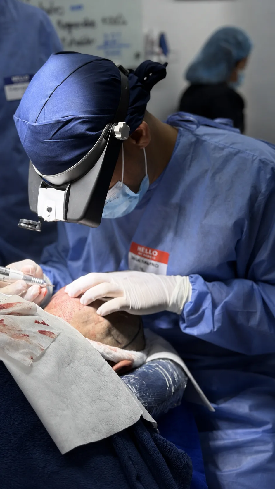 Detalle de marcación y extracción folicular durante un procedimiento de trasplante capilar